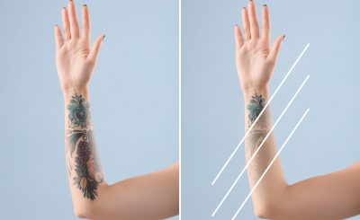 Young woman before and after laser tattoo removal procedure on color background, closeup