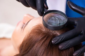 טיפול נכון בנשירת שיער מתמשכת